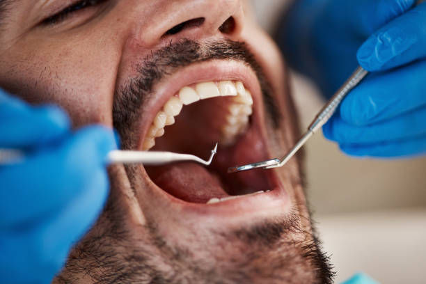 Best Emergency Dentist for Knocked-Out Tooth in Dublin, OH